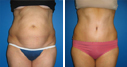 Before & After Photos